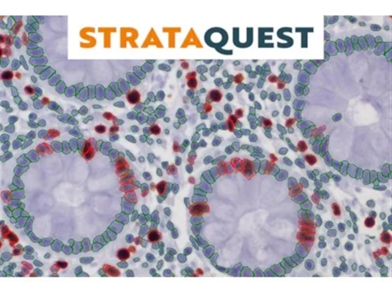 P9 StrataQuest PLUS (TG-影像分析)